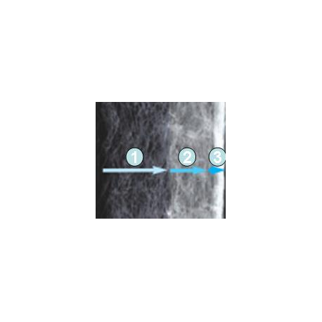 Image 1 - DENNERLE Nano Clean Cartouche de rechange EckFilter Aqua Store